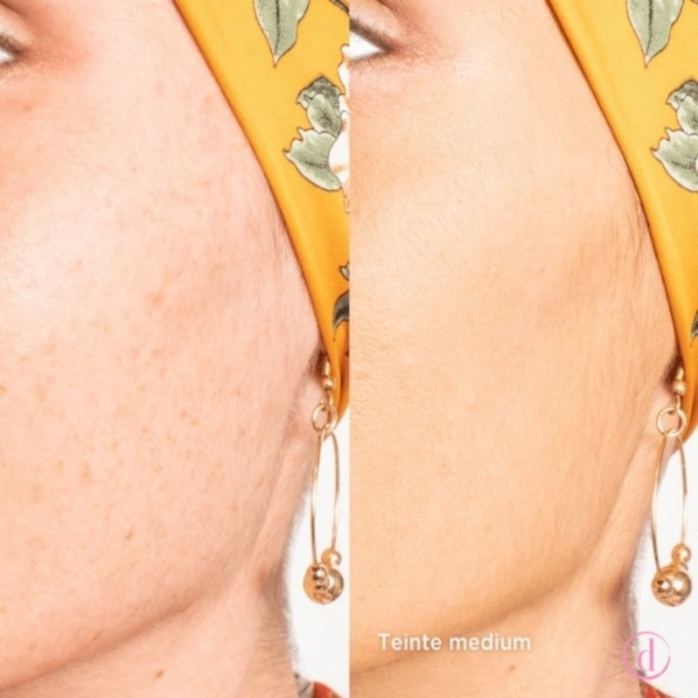 crema iluminadora para quimioterapia