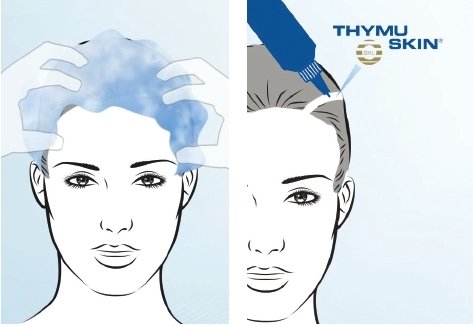 Sistema anti alopecia Thymuskin